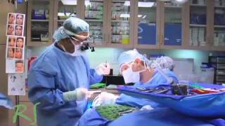 Revision Rhinoplasty with rib grafting