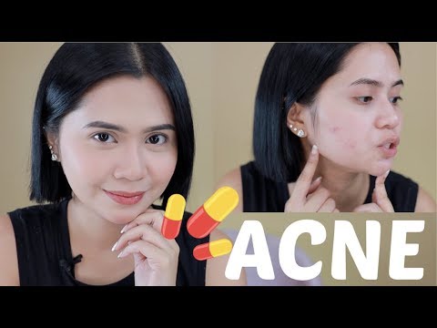 BAD SKIN DAY MAKEUP + ACNE MEDICATION | Anna Cay ♥