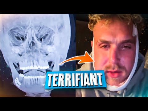 Anthony Joshua broke him… Jake Paul will suffer lifelong consequences!