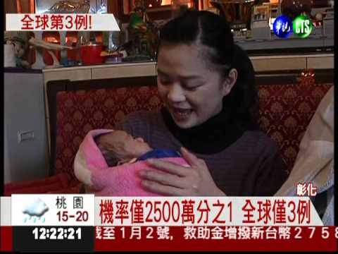 雙子宮婦人產雙胞胎 全台第1例!