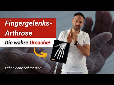 Finger joint osteoarthritis ⚡ The real reason for your finger pain! (It's due to your behavior)