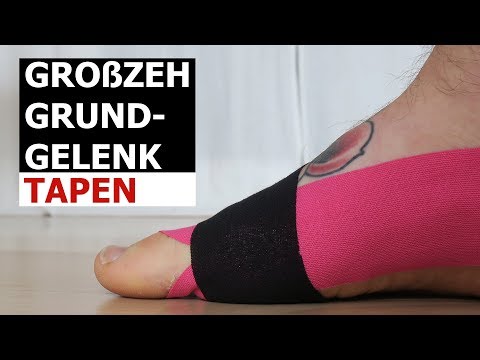 Kinesiology Taping Anleitung großer Zeh Grundgelenk Hallux Valgus