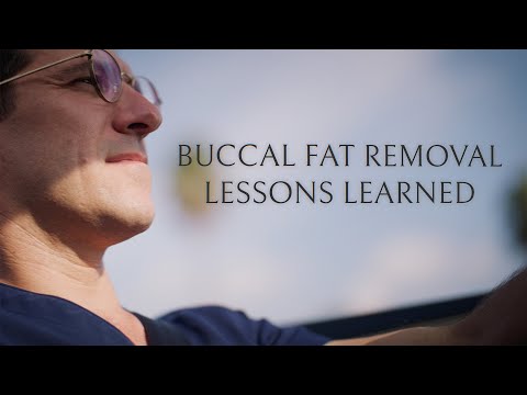 My Buccal Fat Removal: 6-Month Review — Dr. Jonathan Zelken