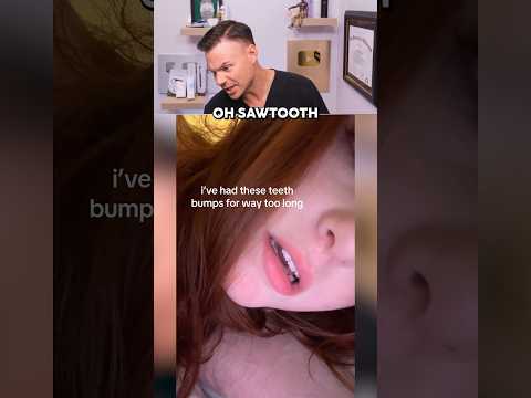 What The Bumps On Your TEETH Actually Are! 😮🦷