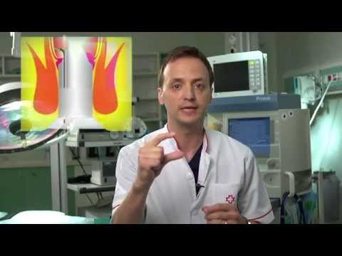 Tratament cu varicose foot video
