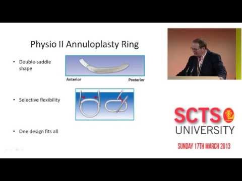 Mitral valve repair with Physio II ring