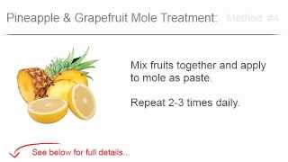 How to Remove Moles? Learn How to Remove Skin Moles at Home
