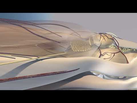 Knee Injection Suprapatellar Approach