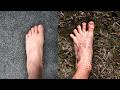 I Wore Zero Drop BAREFOOT Shoes For 2 Years