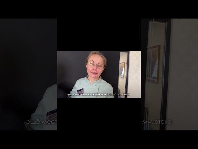 6 месяцев после пластики лица и шеи