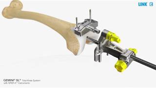 GEMINI SL Total Knee System with SPAR-K Instruments - Surgical technique - EU