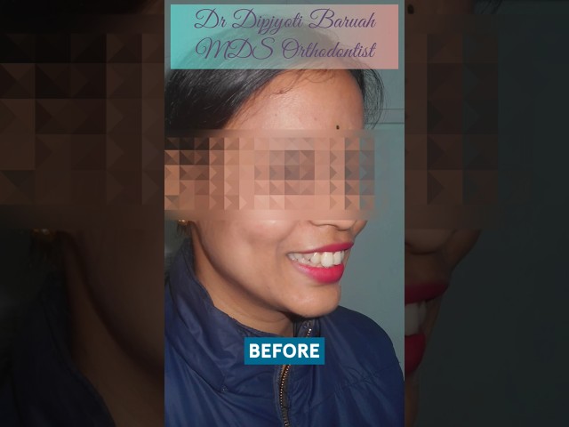 Thumbnail for Post ID: lymqB1O6eHA