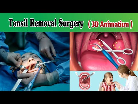 How Earphones and Earbuds Damaging Our Ear Are Earphones Harmful Hindi Urdu