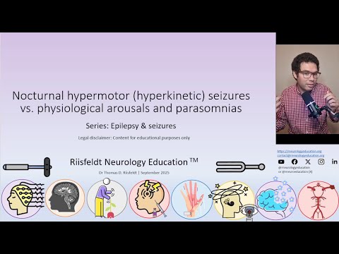 Nocturnal hypermotor (hyperkinetic) seizures vs. physiological arousals & parasomnias