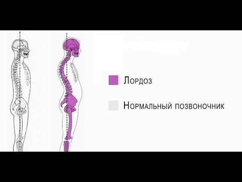I гимнастика для осанки детей Корсеты для коррекции осанки для детей