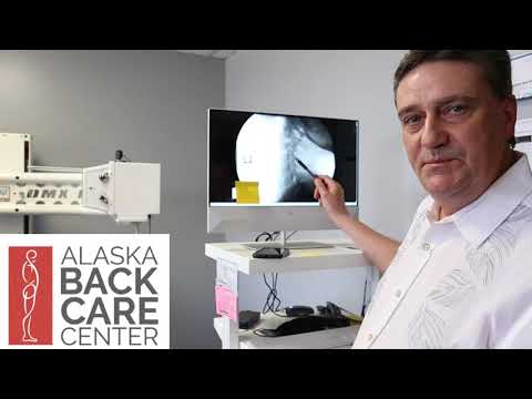 Digital Motion X-ray reveals cervical spine instability