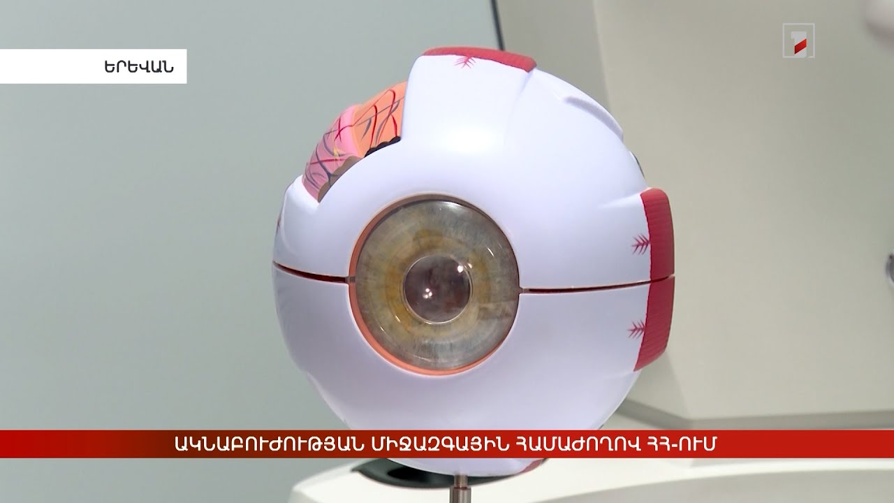 Ակնաբուժության միջազգային համաժողով ՀՀ-ում