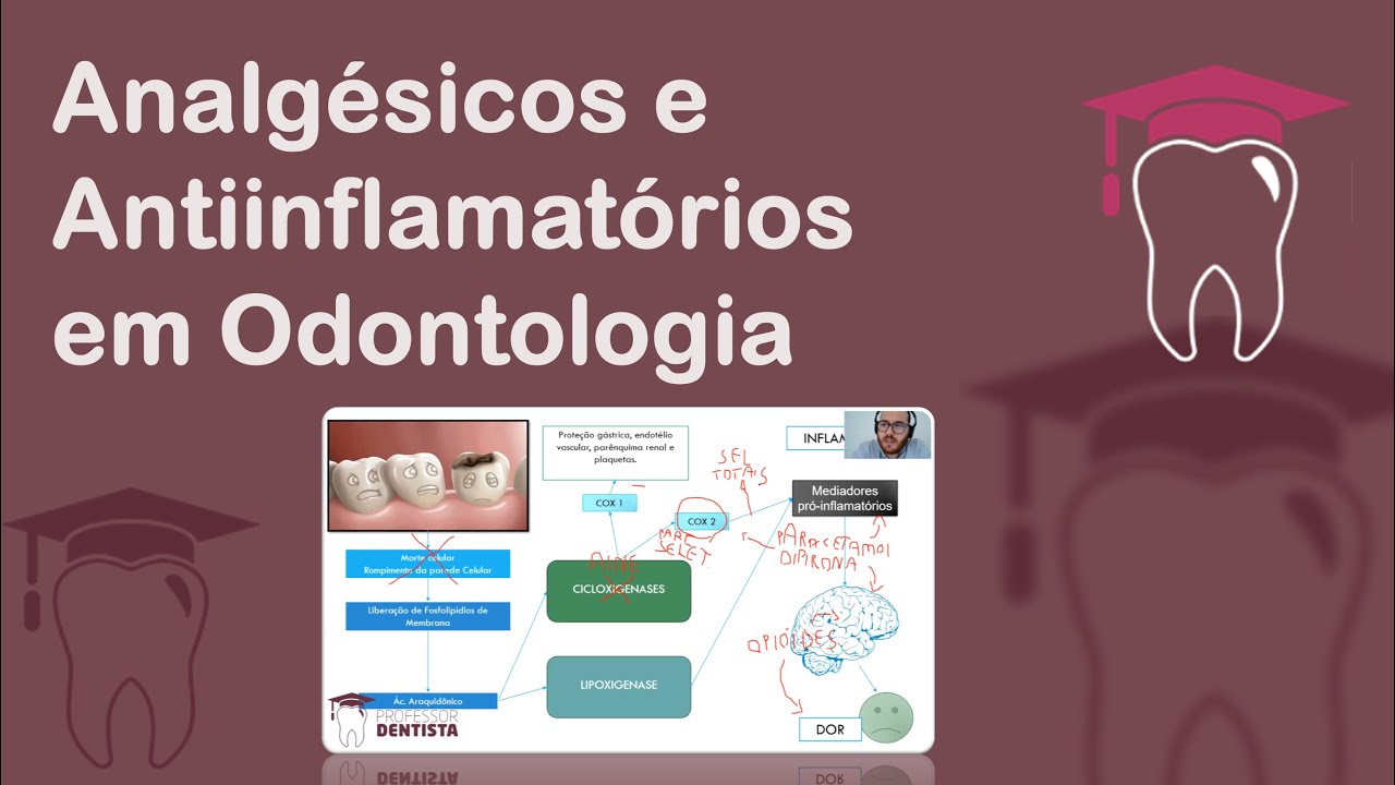 Controle da dor e Inflamação em cirurgia - Analgésicos e Anti-inflamatórios em Odontologia