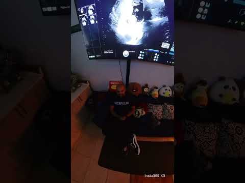 #drescobar #ginecologia #parto