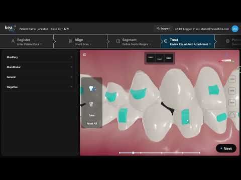 Review Kea AI Auto Attachments
