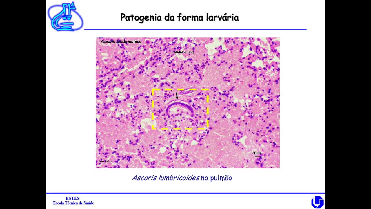 Ascaris lumbricoides
