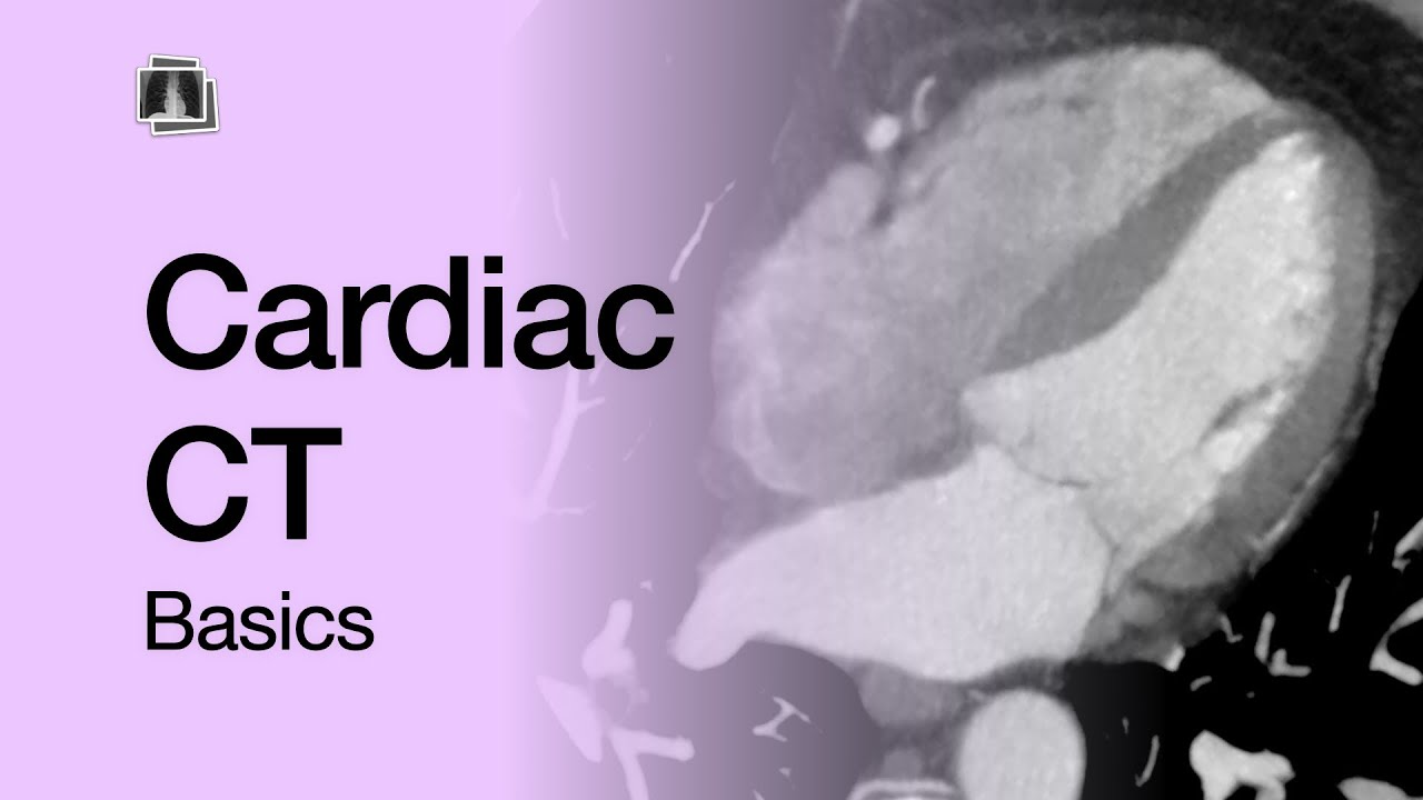 Cardiac CT Basics
