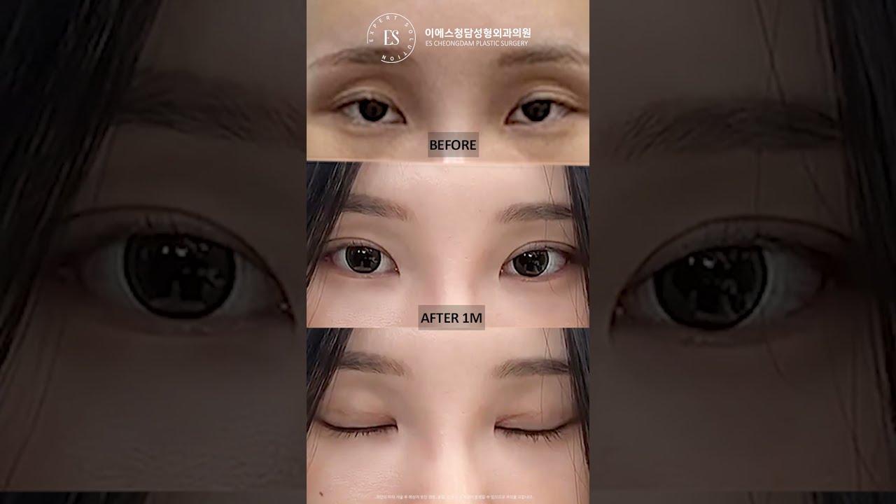 이에스 유튜브