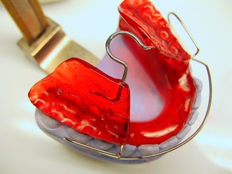 Bionator Grundgerät Herstellung KFO Kieferorthopädie Orthodontics