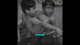 These Are the Rarest Conjoined Twins You’ve Ever Seen — The Last One Is Impossible 😨