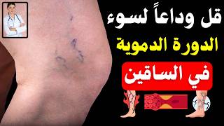 الصحة بعد الستين؟ فيتامين أساسي لكبار السن للحفاظ على صحة الساقين ومنع الجلطات وانسداد الشرايين