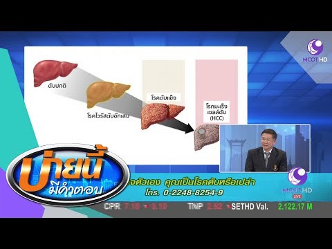 ช่วงเวลาบวกโรคสะเก็ดเงิน โรคสะเก็ดเงิน lipobeyz