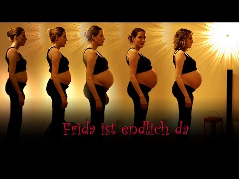 Das Ekzem in nossogubnych die Falten Atopitscheski die Hautentzündung die verbreitete Form die Krankengeschichte