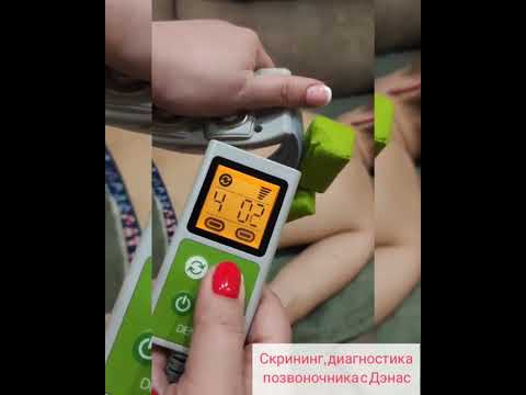 Скрининг, диагностика позвоночника с помощью ДЭНАС - ПКМ. ссылки в описании