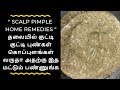 Scalp Pimple Treatment At Home Thalaiyil Koppalam தலை புண் நீங்க