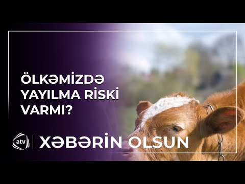 Dabaq xəstəliyinin yeni tipi yayılıb