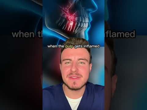 Why are toothaches so painful? 🦷💥🥴 #toothpain #pain #toothache #hurt #pulp