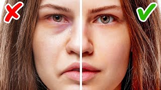 How To Get Rid Of Red Eyes, eyes itching | Cure Eye Redness, eyes itching