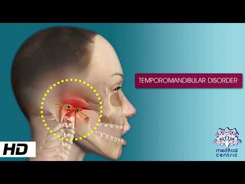 Temporomandibular Disorder, Causes, Signs and Symptoms, Diagnosis and Treatment