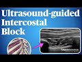 Ultrasound Guided Intercostal Nerve Block