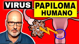 Download lagu Síntomas del VPH (VIRUS del PAPILOMA HUMANO): Cáncer, Vacuna, Diagnóstico y Tratamiento mp3