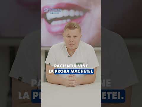 Etapele care se petrec în cazul procedurii de datură fixă