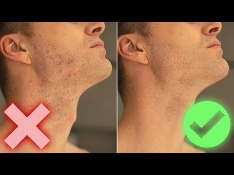RAZOR PICKS on the FACE ● TIPS against PICKS after SHAVING