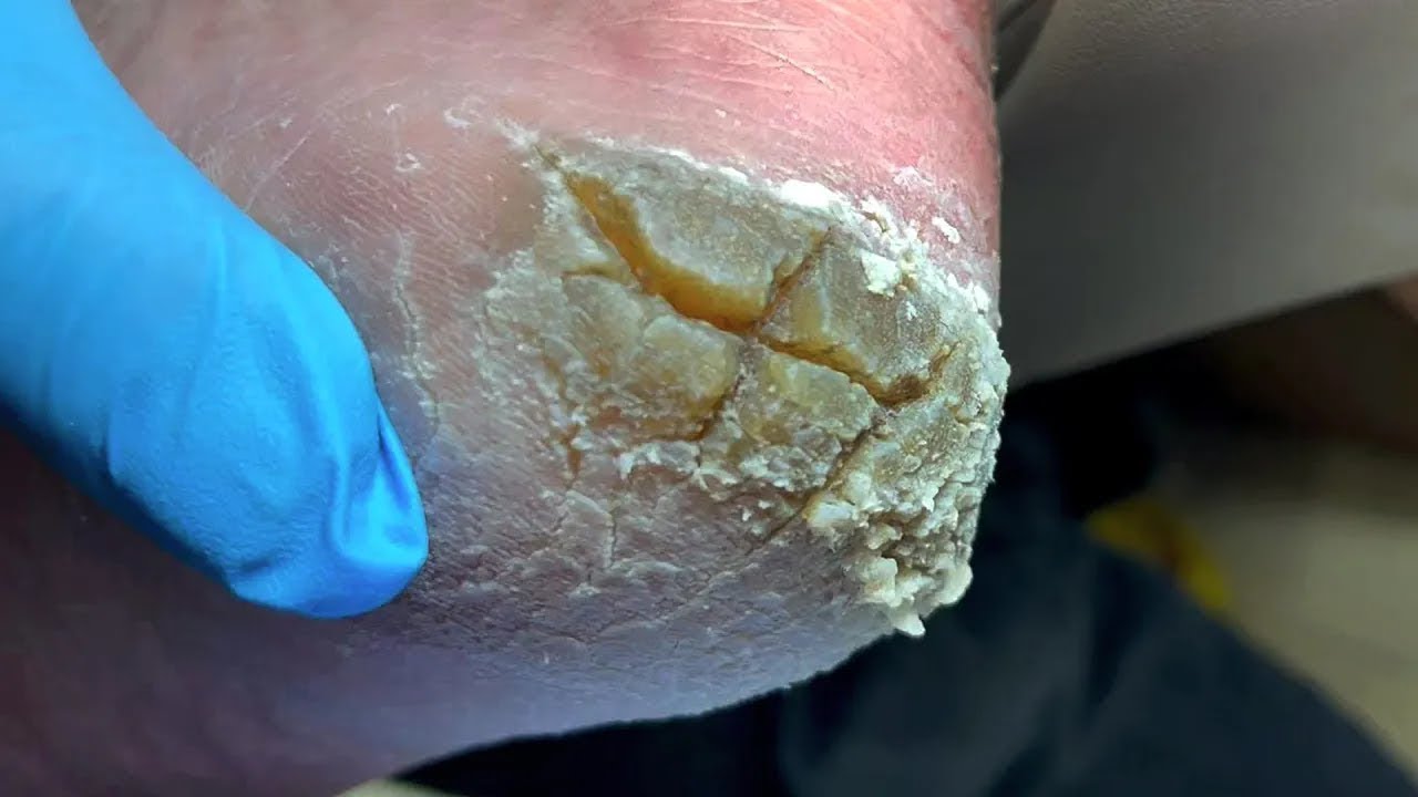 YouTube Thumbnail Downloader FULL HQ IMAGE