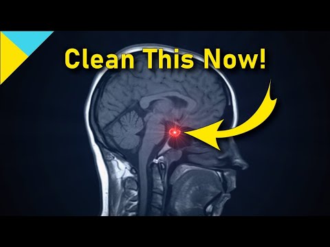 10100 Hertz: Heal Pituitary Gland ❯❯❯ WAIT TILL 6 Mins! • Quantum Miracle Formula Frequency