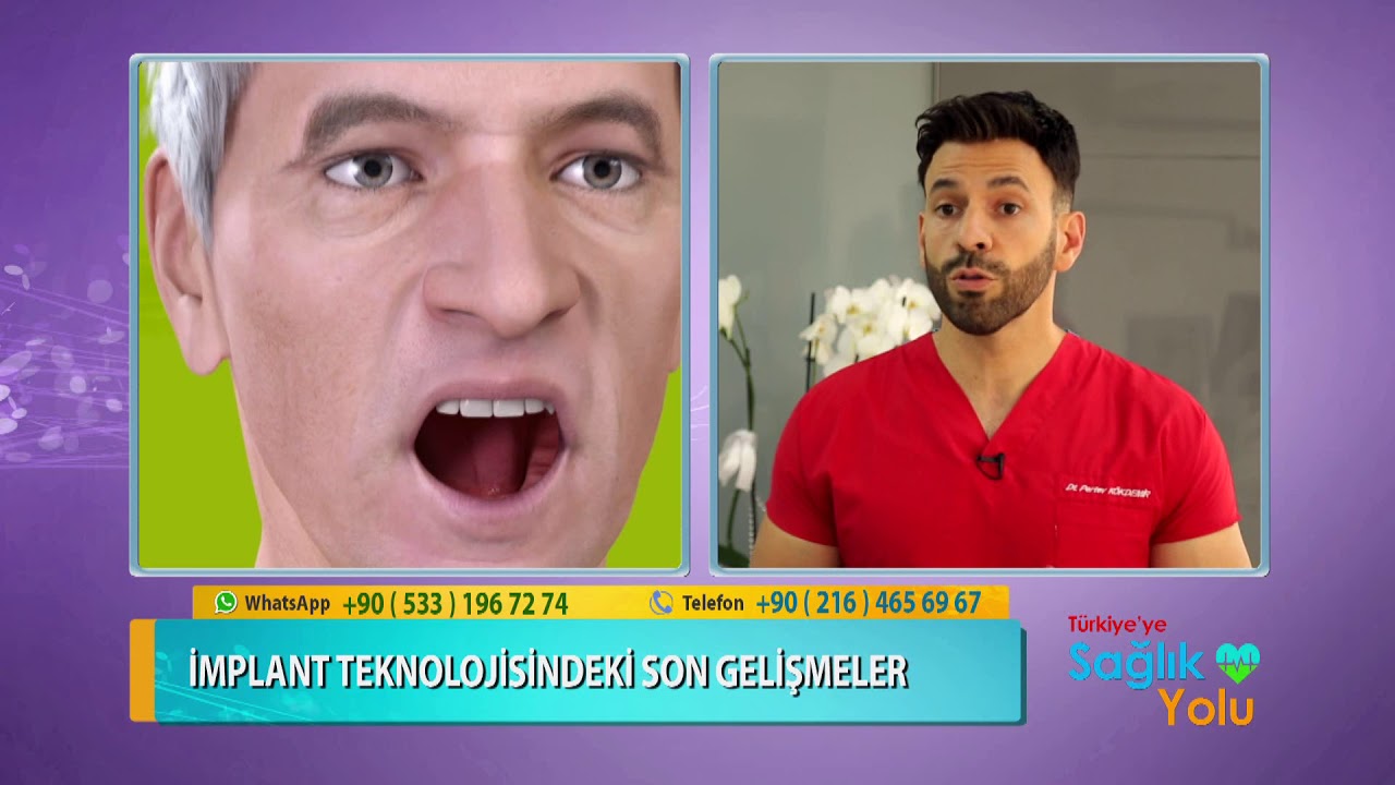 İmplant Tedavisi Nasıl Olur?