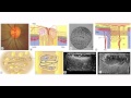 Optic Nerve Head Biomechanics