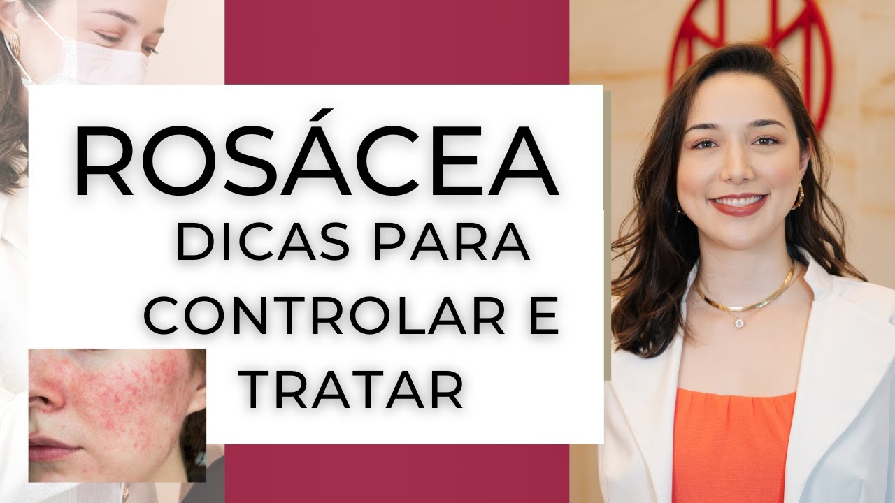 ROSACEA: O que é? E como tratar as Manchas vermelhas na pele | Dicas de Skincare para rosácea