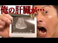 肝臓に問題ありでした【2ヶ月酒を減らした結果】