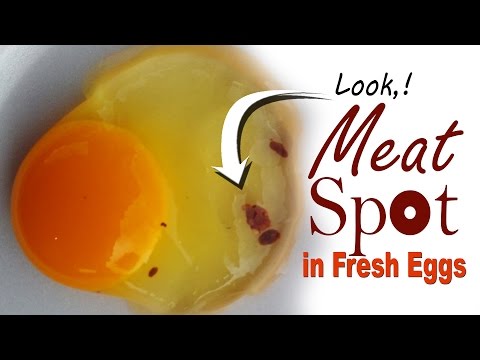 download lagu mp3 mp4 Blood In Raw Egg, download lagu Blood In Raw Egg gratis, unduh video klip Blood In Raw Egg