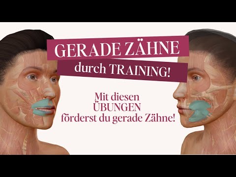 Gerade Zähne ANTRAINIEREN!